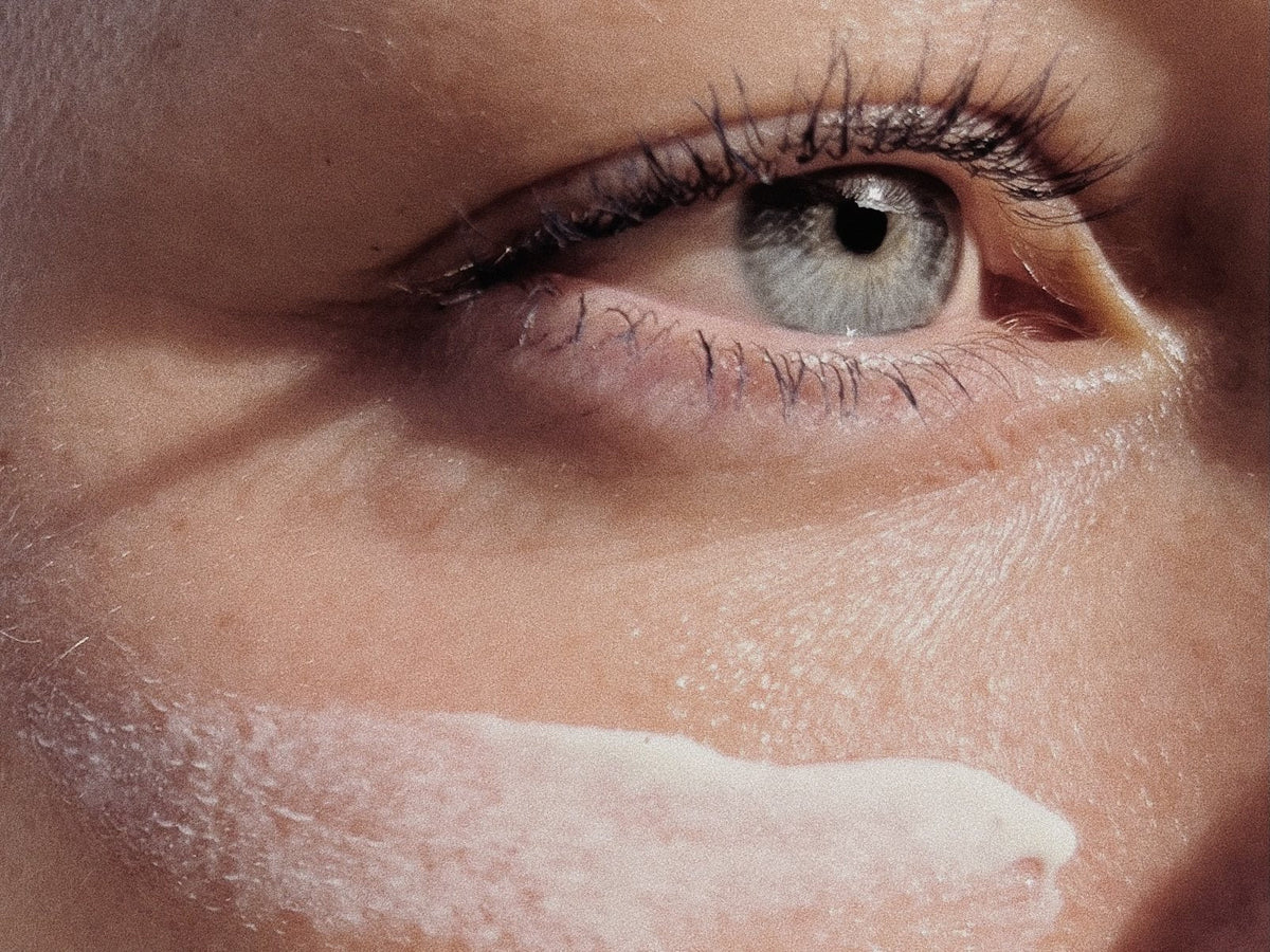 Auge mit Sonnenschutz-Creme auf der Wange